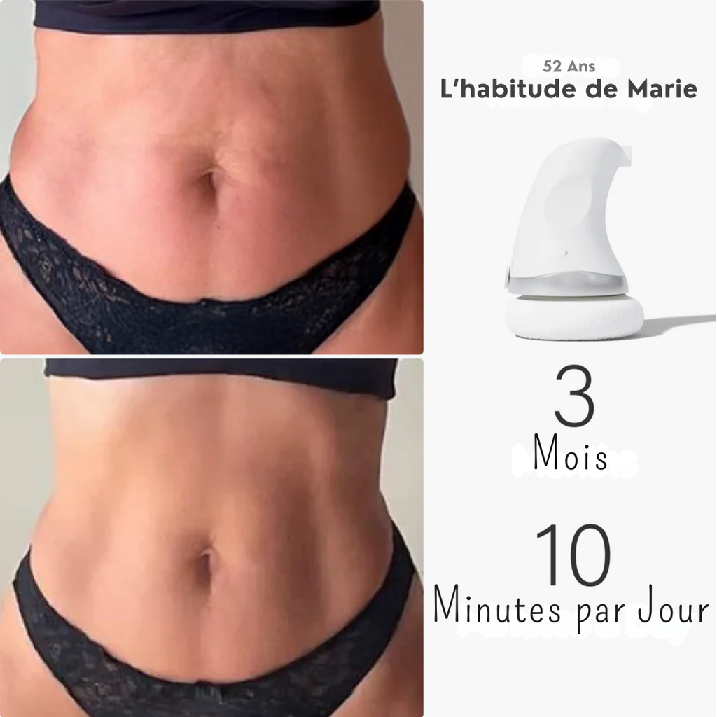 Sculptéa : Masseur Anti Cellulite